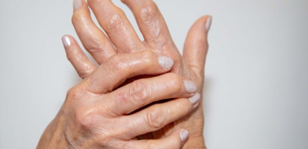 revmatoidni-artritis