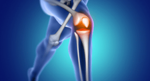 meniskus kolena