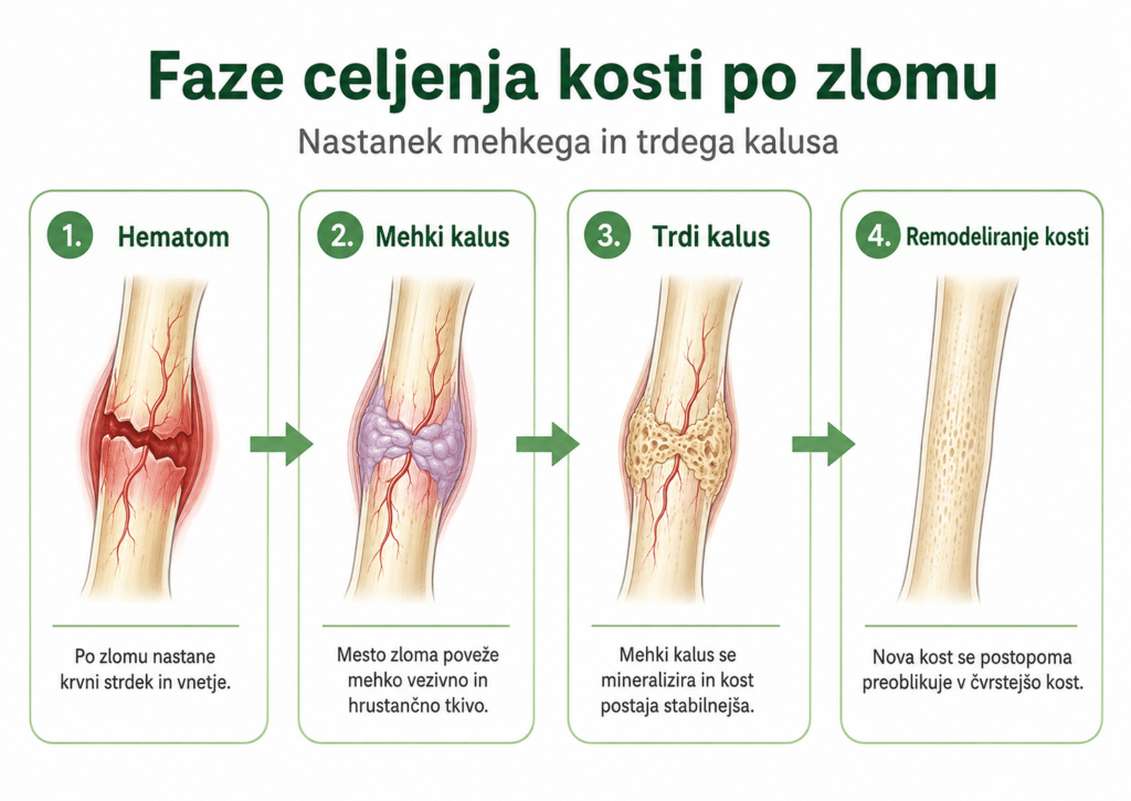 faze celjenja kosti po zlomu – nastanek mehkega in trdega kalusa